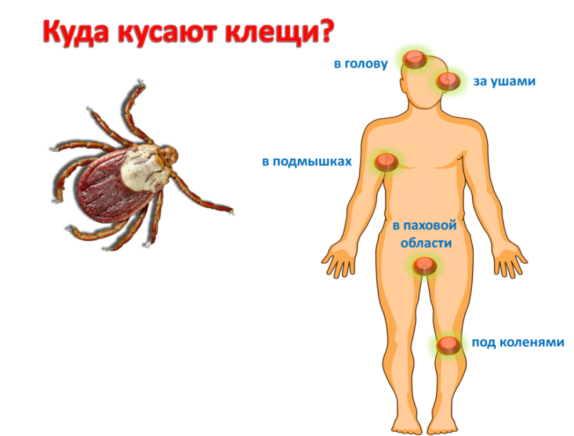 Не только энцефалит. Какие болезни переносят клещи? Аргументы и Факты